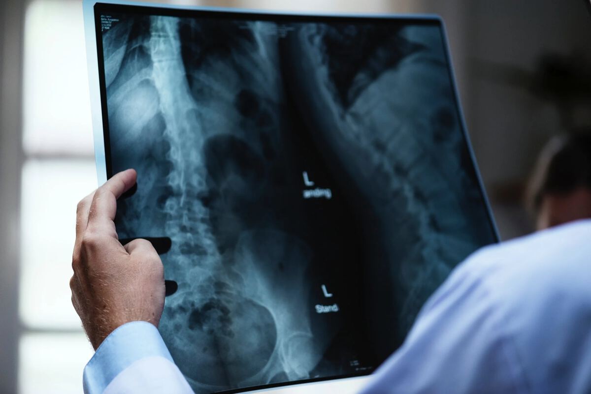 Concussions And Chiropractic: Getting Athletes Back In The Game